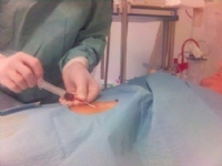 Chọc hút và dẫn lưu dịch màng ngoài tim